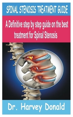 Spinal Stenosis Treatment Guide: A Definitive step by step guide on the best treatment for Spinal Stenosis by Donald, Harvey