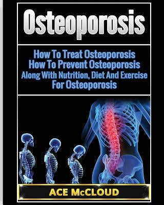 Osteoporosis: How To Treat Osteoporosis: How To Prevent Osteoporosis: Along With Nutrition, Diet And Exercise For Osteoporosis by McCloud, Ace