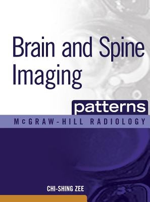 Brain and Spine Imaging Patterns: Brain & Spine Imaging by Zee, Chi-Shing