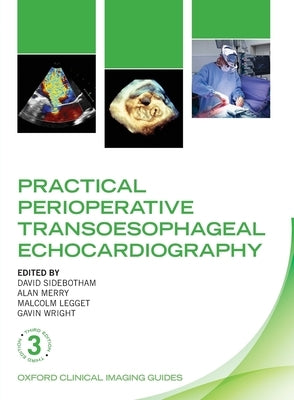 Practical Perioperative Transoesophageal Echocardiography by Sidebotham, David