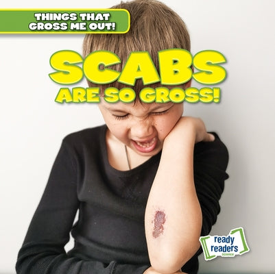 Scabs Are So Gross! by Arnez, Lynda