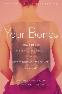 Your Bones: How You Can Prevent Osteoporosis and Have Strong Bones for Life--Naturally by Pizzorno, Lara