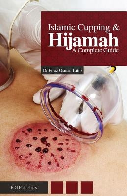 Islamic Cupping & Hijamah: A Complete Guide by Elias, Mufti Afzal Hoosen