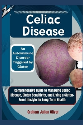 Celiac Disease: An Autoimmune Disorder Triggered by Gluten: Comprehensive Guide to Managing Celiac Disease, Gluten Sensitivity, and Li by Julian Oliver, Graham